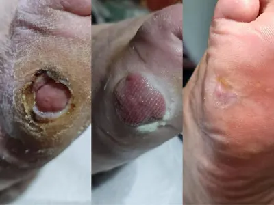 Gabinet Podologiczny BOSO I BOSKO Siedlce/Łosice